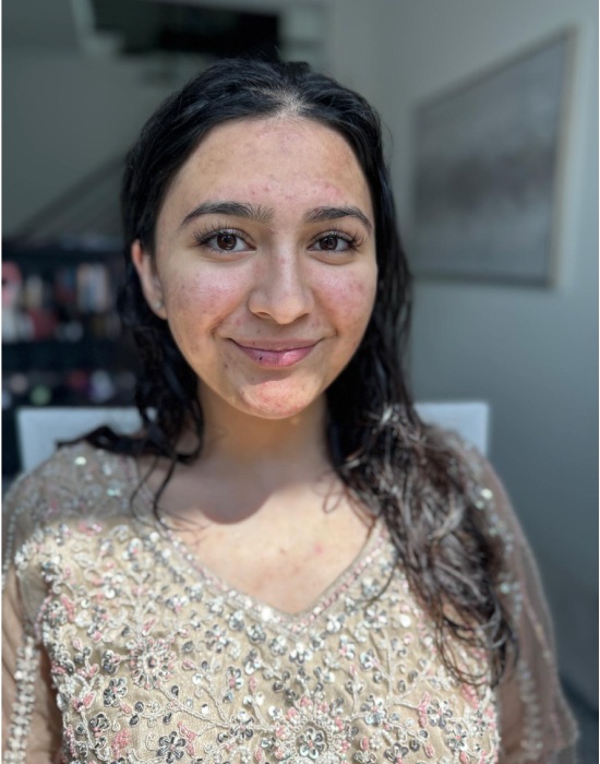 Before transformation